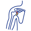 shoulderandelbow-Shoulder-Arthritis-and-Osteoarthritis